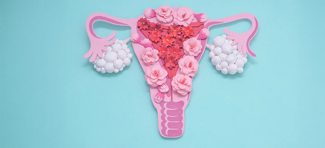 PCOS (polycystic ovary syndrome) treatment – Dr I Ferne Tan Sydney