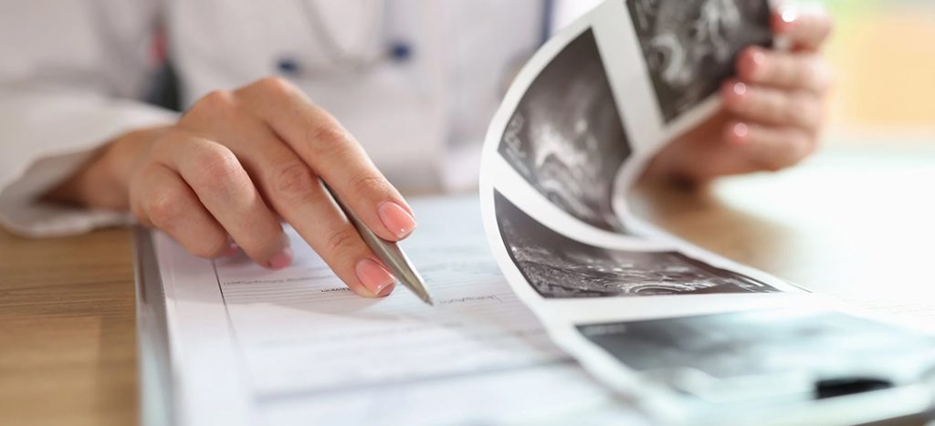 Endometrial polyps treatment – Dr I Ferne Tan Sydney