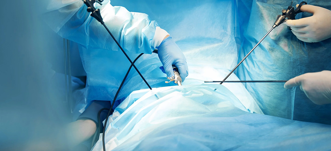 Laparoscopy keyhole surgery – Dr I Ferne Tan Sydney