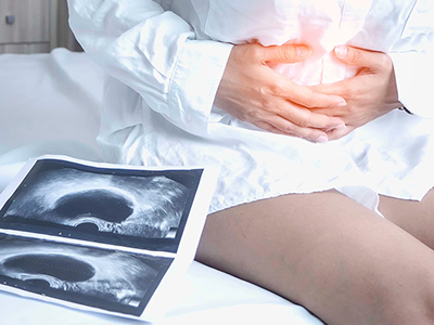 Ovarian cysts diagnosis and care – Dr I Ferne Tan Sydney (thumbnail)