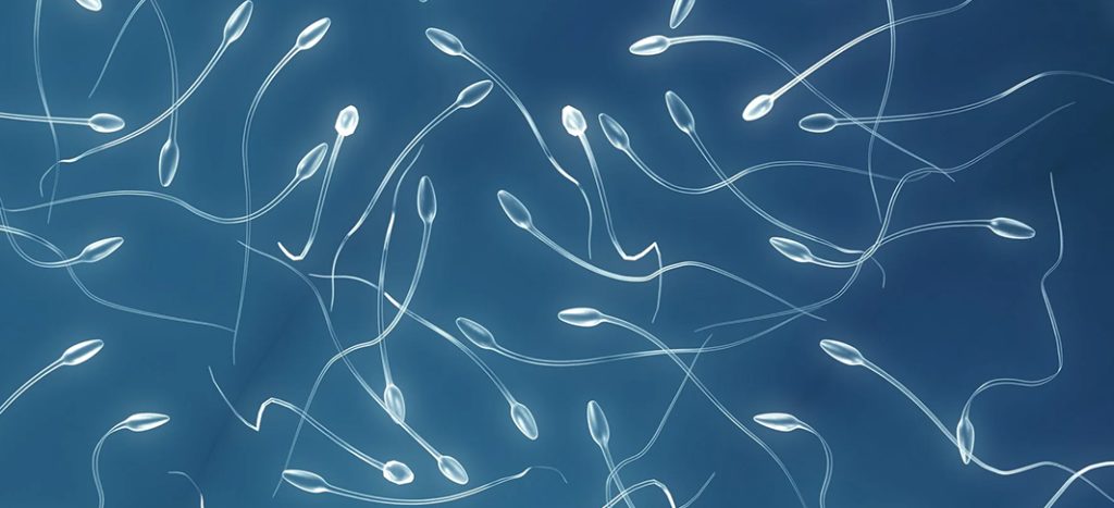 Sperm freezing and preservation – Dr I Ferne Tan Sydney