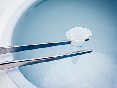 Sperm freezing and preservation – Dr I Ferne Tan Sydney (thumbnail)